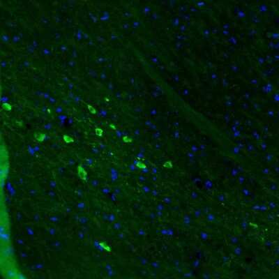 Immunohistochemistry: Dopa Decarboxylase/DDC Antibody (CL2962) [NBP2-46642]