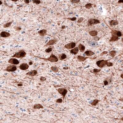 Immunohistochemistry-Paraffin: Dopa Decarboxylase/DDC Antibody (CL2962) [NBP2-46642]