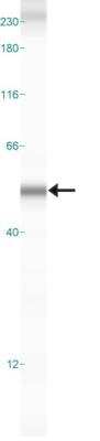 Simple Western: Dopa Decarboxylase/DDC Antibody [NB300-174]