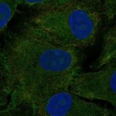 Immunocytochemistry/ Immunofluorescence: Dopamine D1R/DRD1 Antibody [NBP3-17644]