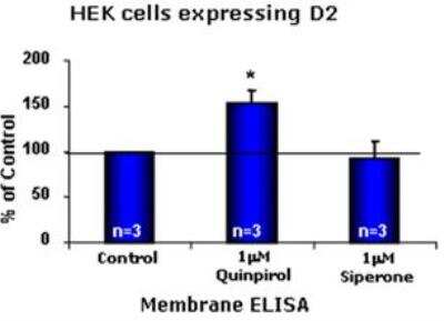 ELISA: Dopamine D2R/DRD2 Antibody [NBP2-88996]