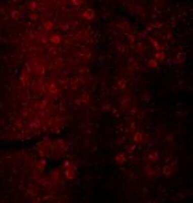 Immunohistochemistry: Dopamine D2R/DRD2 Antibody [NBP2-88996]