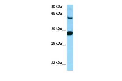Western Blot: Dopamine D3R/DRD3 Antibody [NBP2-84009]