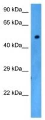 Western Blot: Dopamine D5R/DRD5 Antibody [NBP3-10782]