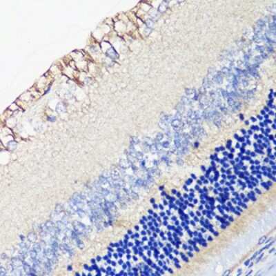 Immunohistochemistry-Paraffin: Dopamine Receptor D4 Antibody - BSA Free [NBP2-92717]