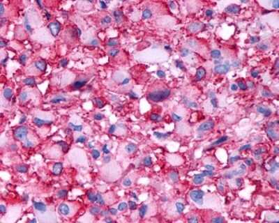 Immunohistochemistry-Paraffin: Dopamine Receptor D4 Antibody - BSA Free [NLS3921]