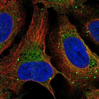 Immunocytochemistry/ Immunofluorescence: Dopamine beta-Hydroxylase Antibody [NBP2-57836]