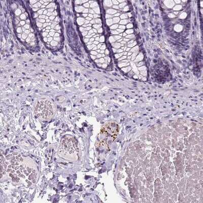 Immunohistochemistry-Paraffin: Dopamine beta-Hydroxylase Antibody [NBP2-55677]