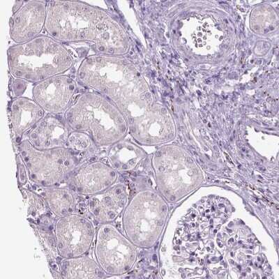 Immunohistochemistry-Paraffin: Dopamine beta-Hydroxylase Antibody [NBP2-55677]