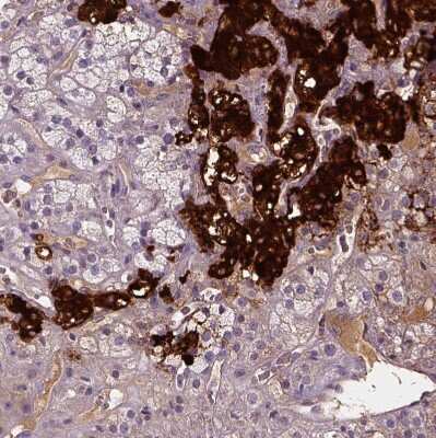 Immunohistochemistry-Paraffin: Dopamine beta-Hydroxylase Antibody [NBP2-57836]