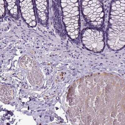 Immunohistochemistry-Paraffin: Dopamine beta-Hydroxylase Antibody [NBP2-57836]