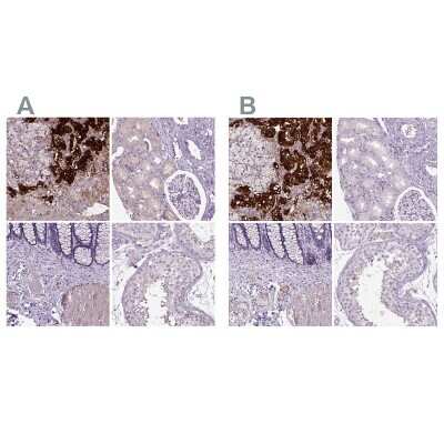 Immunohistochemistry-Paraffin: Dopamine beta-Hydroxylase Antibody [NBP2-57836]