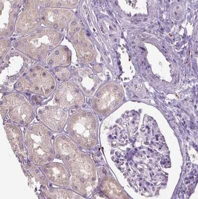 Immunohistochemistry-Paraffin: Dopamine beta-Hydroxylase Antibody [NBP2-57836]