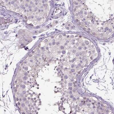 Immunohistochemistry-Paraffin: Dopamine beta-Hydroxylase Antibody [NBP2-57836]