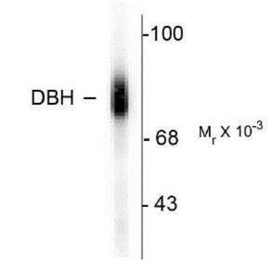 Western Blot: Dopamine beta-Hydroxylase Antibody [NB300-111]