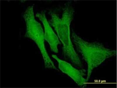 Immunocytochemistry/ Immunofluorescence: Doublecortin Antibody (1G12) [H00001641-M01]