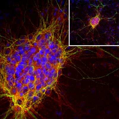 Immunocytochemistry/ Immunofluorescence: Doublecortin Antibody (3E1) [NBP1-92684]