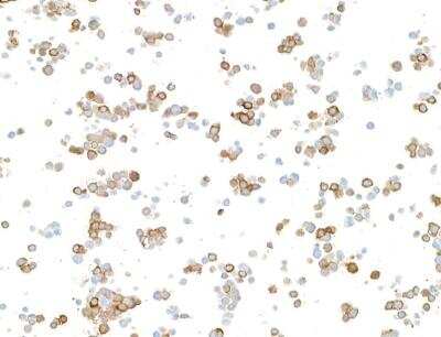 Immunocytochemistry: Doublecortin Antibody (BLR168J) [NBP3-14742]