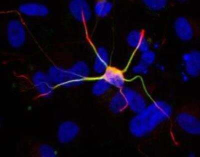 Immunocytochemistry/ Immunofluorescence: Doublecortin Antibody [NBP1-32662]