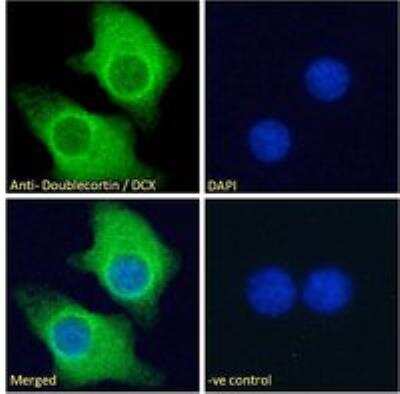 Immunocytochemistry/ Immunofluorescence: Doublecortin Antibody [NBP1-72042]