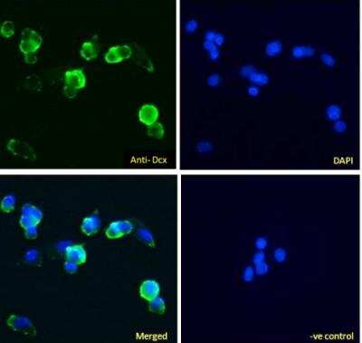 Immunocytochemistry/ Immunofluorescence: Doublecortin Antibody [NBP2-26149]