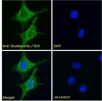 Immunocytochemistry/ Immunofluorescence: Doublecortin Antibody [NBP2-69992]