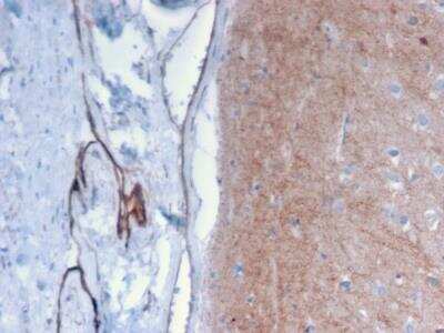 Immunohistochemistry-Paraffin: Drebrin 1 Antibody (DBN1/2879) - Azide and BSA Free [NBP2-79901]