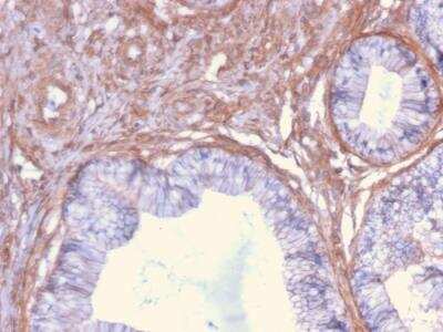 Immunohistochemistry-Paraffin: Drebrin 1 Antibody (DBN1/2879) - Azide and BSA Free [NBP2-79901]