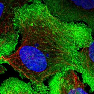 Immunocytochemistry/ Immunofluorescence: Drebrin 1 Antibody [NBP2-38650]
