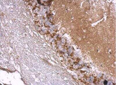 Immunohistochemistry-Paraffin: Drebrin 1 Antibody [NBP2-14932]