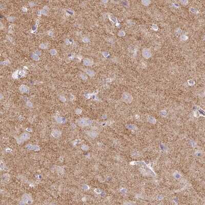 Immunohistochemistry-Paraffin: Drebrin 1 Antibody [NBP2-38650]