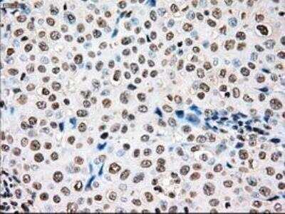 Immunohistochemistry-Paraffin: Dtk/TYRO3 Antibody (OTI2C4) [NBP1-48040]