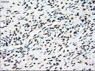 Immunohistochemistry-Paraffin: Dtk/TYRO3 Antibody (OTI2C4) [NBP1-48040]