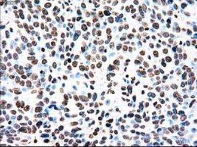 Immunohistochemistry-Paraffin: Dtk/TYRO3 Antibody (OTI2C4) [NBP1-48040]