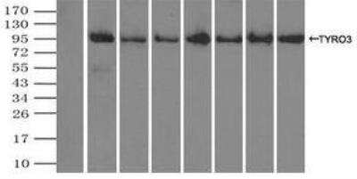 Immunoprecipitation: Dtk/TYRO3 Antibody (OTI2C4) [NBP1-48040]