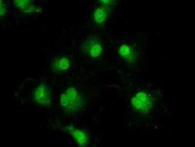 Immunocytochemistry/ Immunofluorescence: Dtk/TYRO3 Antibody (OTI2C4) - Azide and BSA Free [NBP2-71331]