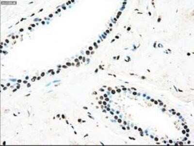 Immunohistochemistry: Dtk/TYRO3 Antibody (OTI2C4) - Azide and BSA Free [NBP2-71331]
