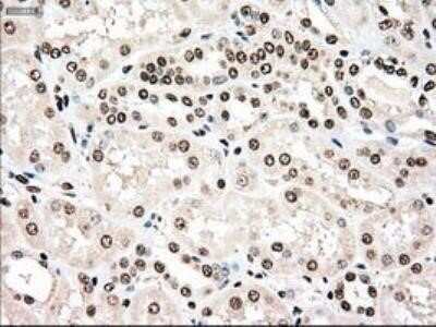 Immunohistochemistry: Dtk/TYRO3 Antibody (OTI2C4) - Azide and BSA Free [NBP2-71331]