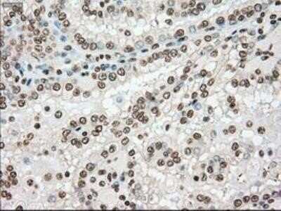 Immunohistochemistry: Dtk/TYRO3 Antibody (OTI2C4) - Azide and BSA Free [NBP2-71331]