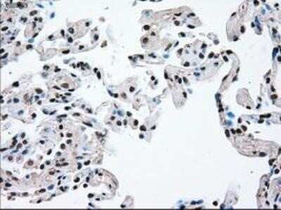 Immunohistochemistry: Dtk/TYRO3 Antibody (OTI2C4) - Azide and BSA Free [NBP2-71331]