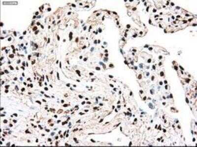 Immunohistochemistry: Dtk/TYRO3 Antibody (OTI2C4) - Azide and BSA Free [NBP2-71331]