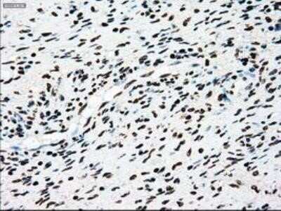 Immunohistochemistry: Dtk/TYRO3 Antibody (OTI2C4) - Azide and BSA Free [NBP2-71331]