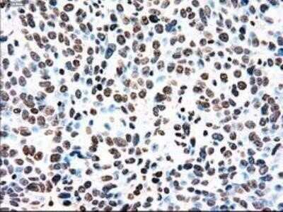 Immunohistochemistry: Dtk/TYRO3 Antibody (OTI2C4) - Azide and BSA Free [NBP2-71331]