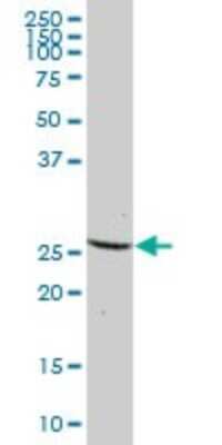 Western Blot: Dynactin 6 Antibody [H00010671-B01P]