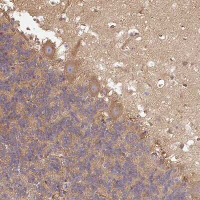 Immunohistochemistry-Paraffin: Dynactin Subunit 1/DCTN1 Antibody [NBP2-33976]