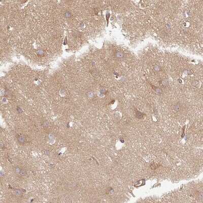 Immunohistochemistry-Paraffin: Dynactin Subunit 1/DCTN1 Antibody [NBP2-33976]