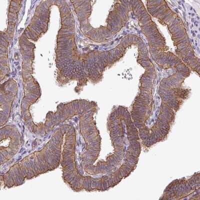 Immunohistochemistry-Paraffin: Dynactin Subunit 1/DCTN1 Antibody [NBP2-33976]