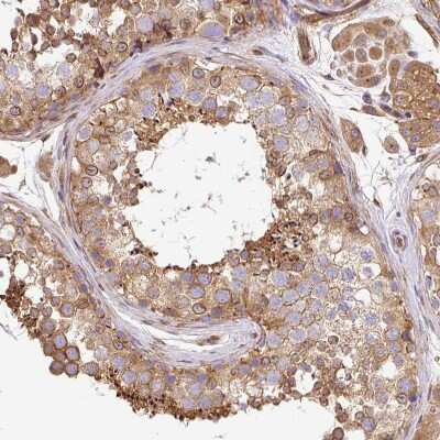 Immunohistochemistry-Paraffin: Dynactin Subunit 1/DCTN1 Antibody [NBP2-33976]