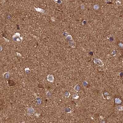Immunohistochemistry-Paraffin: Dynactin Subunit 2/DCTN2/DCTN-50 Antibody [NBP1-85277]