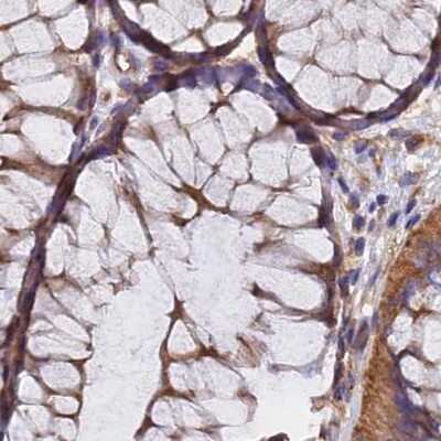 Immunohistochemistry-Paraffin: Dynactin Subunit 2/DCTN2/DCTN-50 Antibody [NBP1-85278]